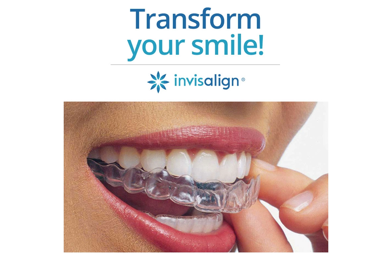 Invisalign